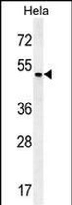ZMYND17 Antibody in Western Blot (WB)