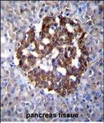 PCDH20 Antibody in Immunohistochemistry (Paraffin) (IHC (P))