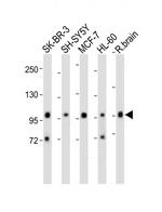 PCDH20 Antibody in Western Blot (WB)