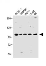 PCDH20 Antibody in Western Blot (WB)