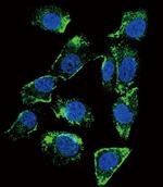 betacellulin Antibody in Immunocytochemistry (ICC/IF)