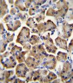 betacellulin Antibody in Immunohistochemistry (Paraffin) (IHC (P))