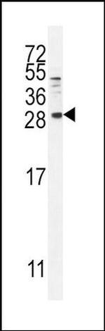 betacellulin Antibody in Western Blot (WB)