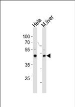 TBX6 Antibody in Western Blot (WB)
