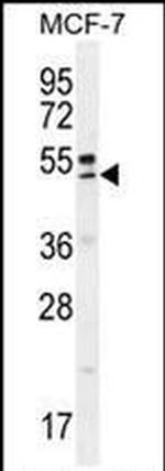 QTRTD1 Antibody in Western Blot (WB)