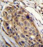 SSH3 Antibody in Immunohistochemistry (Paraffin) (IHC (P))