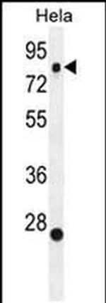 SSH3 Antibody in Western Blot (WB)