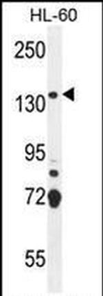 SOS2 Antibody in Western Blot (WB)