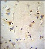 AGBL5 Antibody in Immunohistochemistry (Paraffin) (IHC (P))