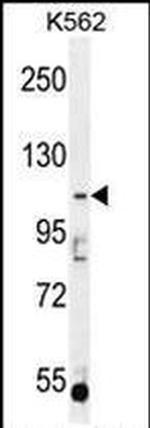 AGBL5 Antibody in Western Blot (WB)