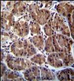 SOCS4 Antibody in Immunohistochemistry (Paraffin) (IHC (P))
