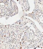 COL8A2 Antibody in Immunohistochemistry (Paraffin) (IHC (P))
