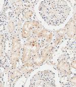 COL8A2 Antibody in Immunohistochemistry (Paraffin) (IHC (P))