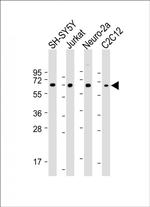 COL8A2 Antibody in Western Blot (WB)