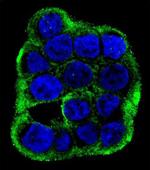 CLCN7 Antibody in Immunocytochemistry (ICC/IF)