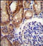 CLCN7 Antibody in Immunohistochemistry (Paraffin) (IHC (P))