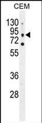 CLCN7 Antibody in Western Blot (WB)