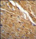 TBC1D13 Antibody in Immunohistochemistry (Paraffin) (IHC (P))