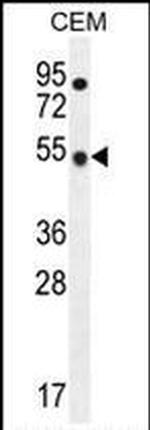 TBC1D13 Antibody in Western Blot (WB)