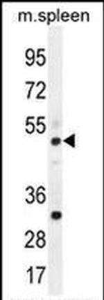 TBC1D13 Antibody in Western Blot (WB)