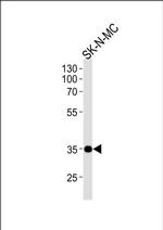 Nkx1.1 Antibody in Western Blot (WB)