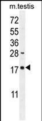 CHOP Antibody in Western Blot (WB)