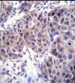 DVL3 Antibody in Immunohistochemistry (Paraffin) (IHC (P))