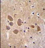 AP1M1 Antibody in Immunohistochemistry (Paraffin) (IHC (P))
