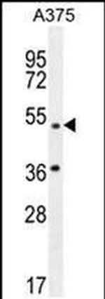 AP1M1 Antibody in Western Blot (WB)