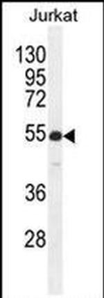 RBPJL Antibody in Western Blot (WB)