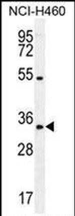 PURB Antibody in Western Blot (WB)