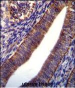 COL21A1 Antibody in Immunohistochemistry (Paraffin) (IHC (P))