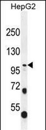 COL21A1 Antibody in Western Blot (WB)