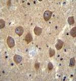 PCDHB3 Antibody in Immunohistochemistry (Paraffin) (IHC (P))