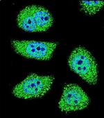 PAK6 Antibody in Immunocytochemistry (ICC/IF)