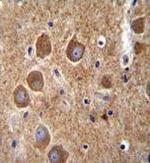 PAK6 Antibody in Immunohistochemistry (Paraffin) (IHC (P))