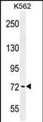 PAK6 Antibody in Western Blot (WB)