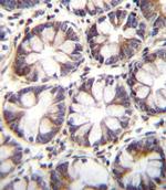 SLC36A1 Antibody in Immunohistochemistry (Paraffin) (IHC (P))