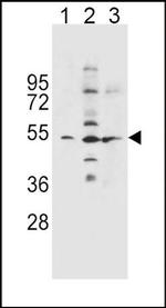 SLC36A1 Antibody in Western Blot (WB)