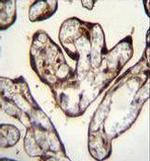PYGO1 Antibody in Immunohistochemistry (Paraffin) (IHC (P))