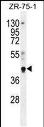 PYGO1 Antibody in Western Blot (WB)