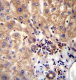 DVL1 Antibody in Immunohistochemistry (Paraffin) (IHC (P))