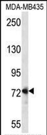 DVL1 Antibody in Western Blot (WB)