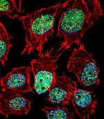 FOXO6 Antibody in Immunocytochemistry (ICC/IF)