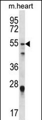 FOXO6 Antibody in Western Blot (WB)