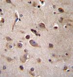 TSN Antibody in Immunohistochemistry (Paraffin) (IHC (P))