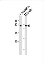 SOX15 Antibody in Western Blot (WB)