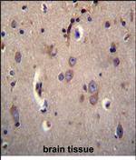 DTNA Antibody in Immunohistochemistry (Paraffin) (IHC (P))