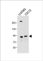 DTNA Antibody in Western Blot (WB)