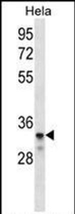 LDLRAD2 Antibody in Western Blot (WB)